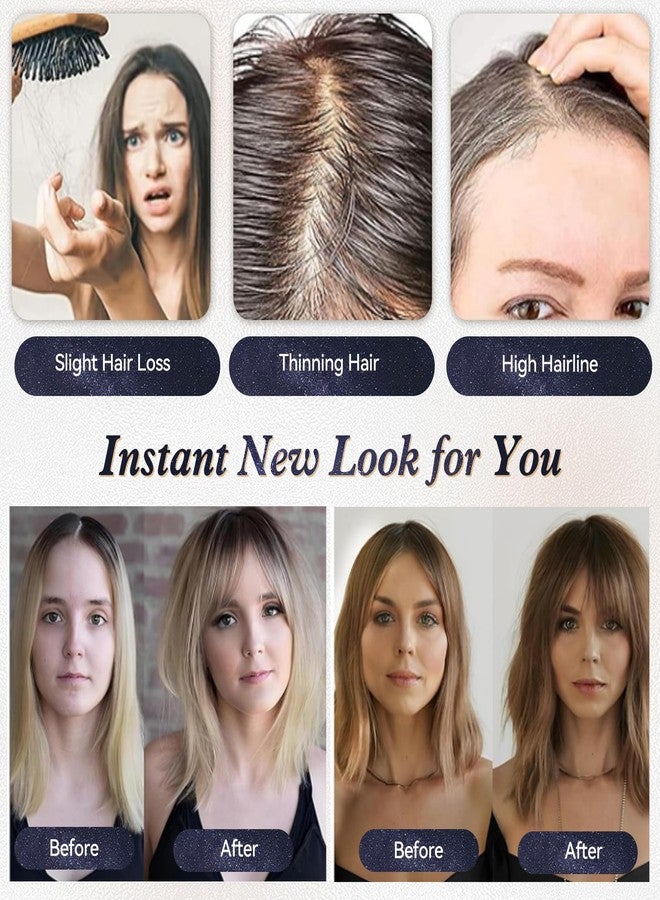 starluck Hair Toppers for Women Real Human Hair No Bangs 3.5"*4"Hand-Tied Swiss Lace Base 12in 100% Remy Human HairTopper for Women with ThinningHair(ombre Light Blonde) - Image 4